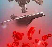 Dešifriranja test krvi za bilirubin