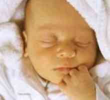 Simptomi žutice u novorođenčadi