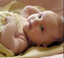 Žutica u novorođenčadi